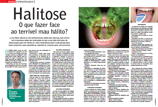 Halitose, artigo de Imprensa da Clínica Dentária Jardim dos Arcos